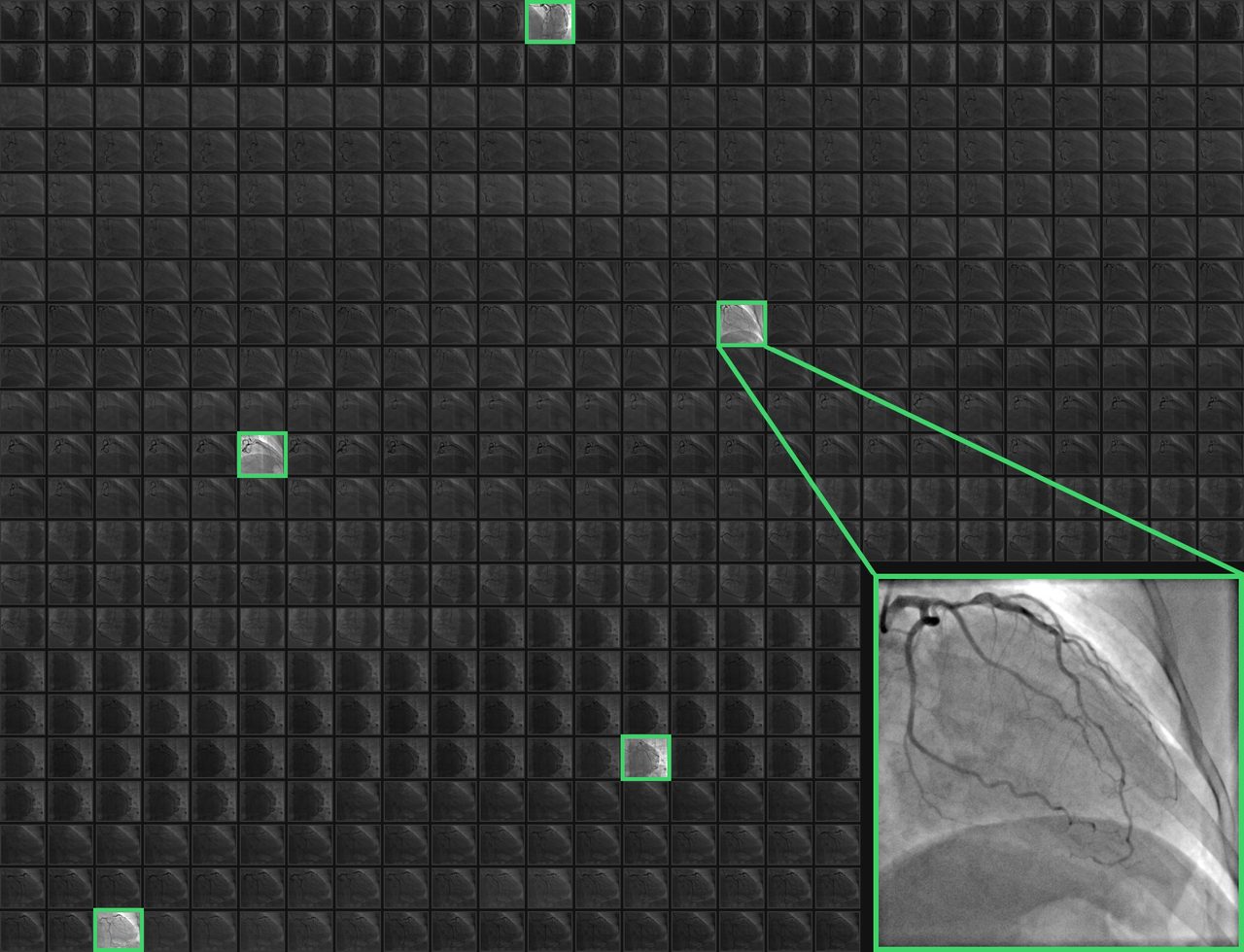 The same 500 frames with the frames CardioTwin picked outlined in green
